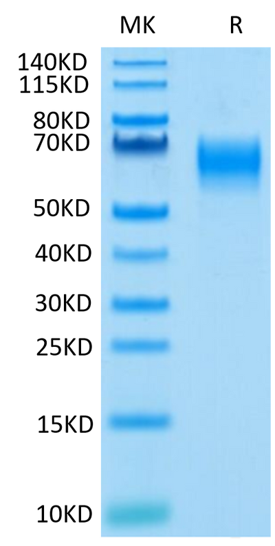 Human IL-1 Rrp2 on Tris-Bis PAGE under reduced condition. The purity is greater than 95%.