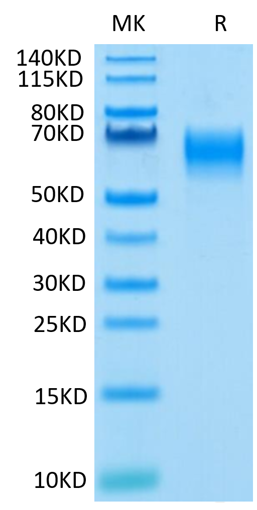 Human IL-1 Rrp2 on Tris-Bis PAGE under reduced condition. The purity is greater than 95%.