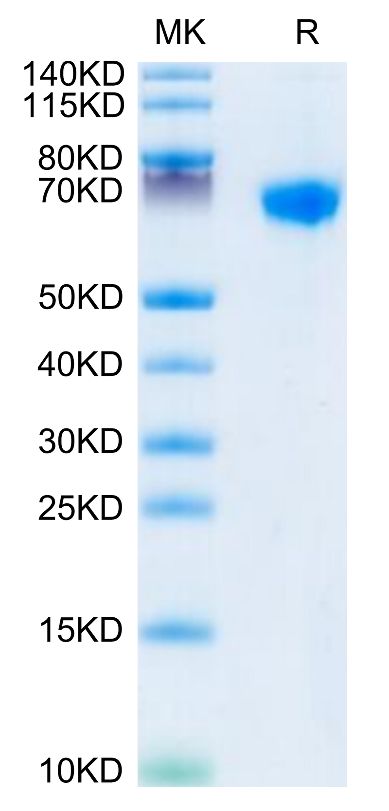 Rhesus macaque LILRB1 on Tris-Bis PAGE under reduced conditions. The purity is greater than 95%.