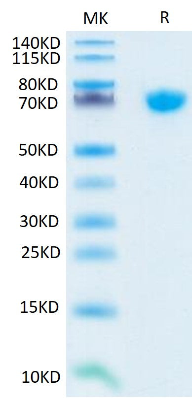 Human TNFSF15 Trimer on Tris-Bis PAGE under reduced condition. The purity is greater than 95%.