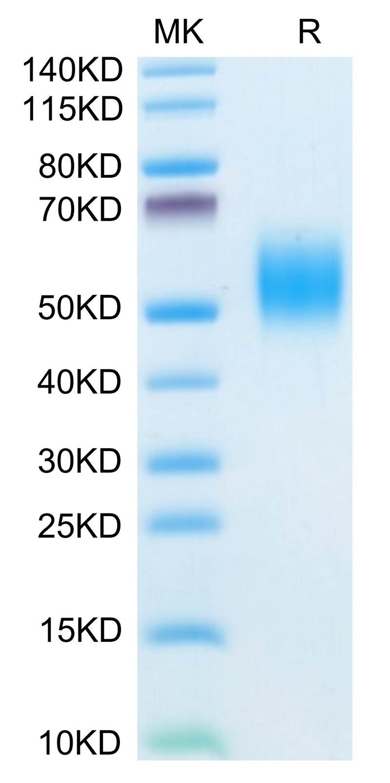 Mouse FGFR2 beta (IIIb) on Tris-Bis PAGE under reduced conditions. The purity is greater than 95%.