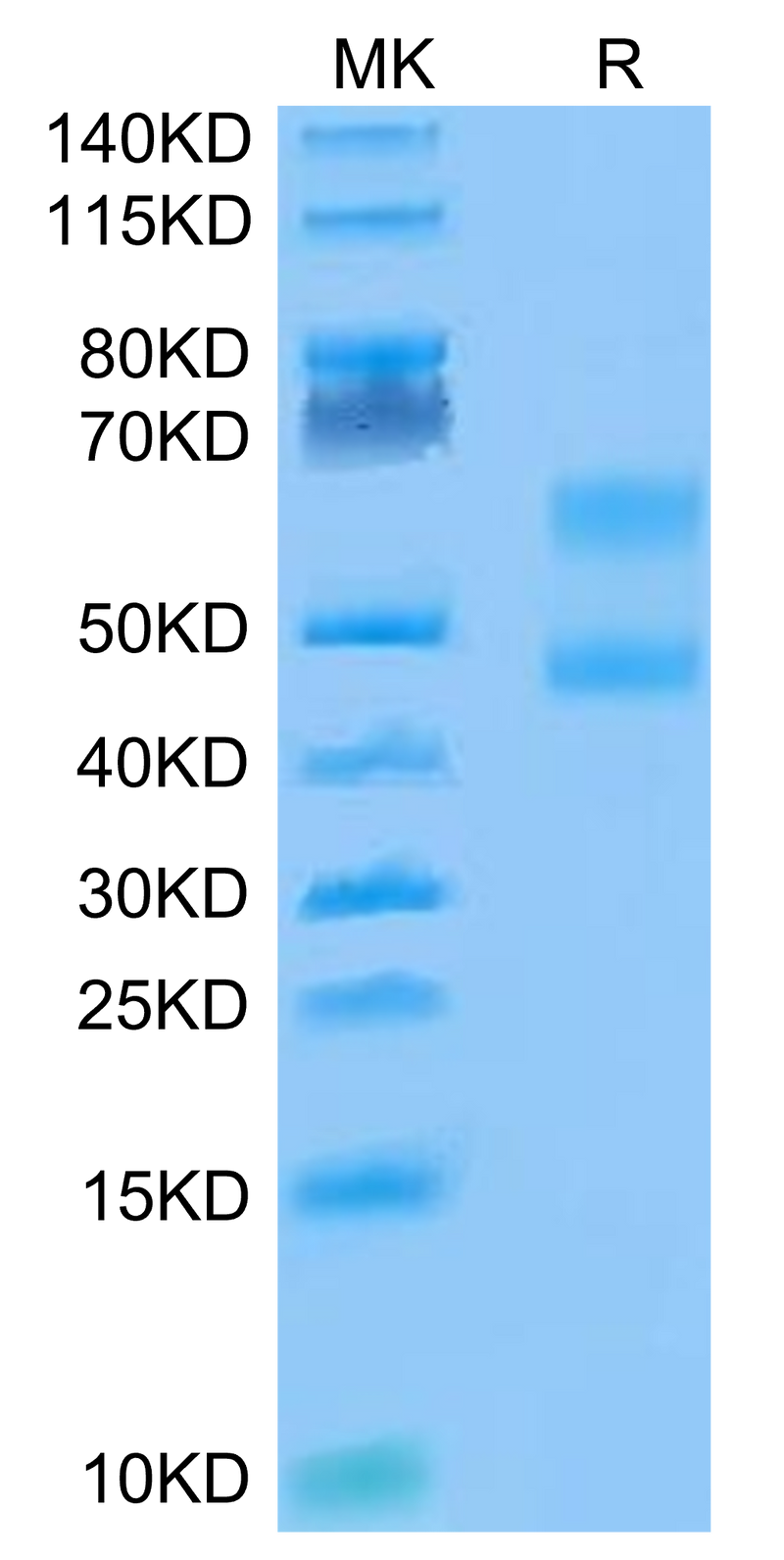 Biotinylated Cynomolgus CD3E&CD3D on Tris-Bis PAGE under reduced conditions. The purity is greater than 95%.