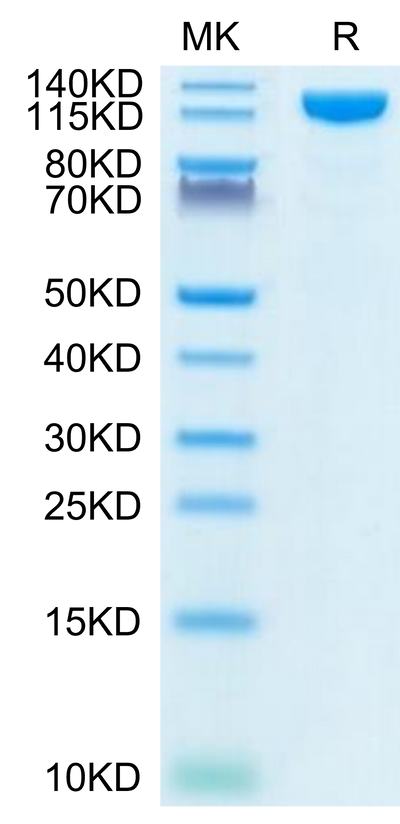 Human ACE2 on Tris-Bis PAGE under reduced condition. The purity is greater than 95%.