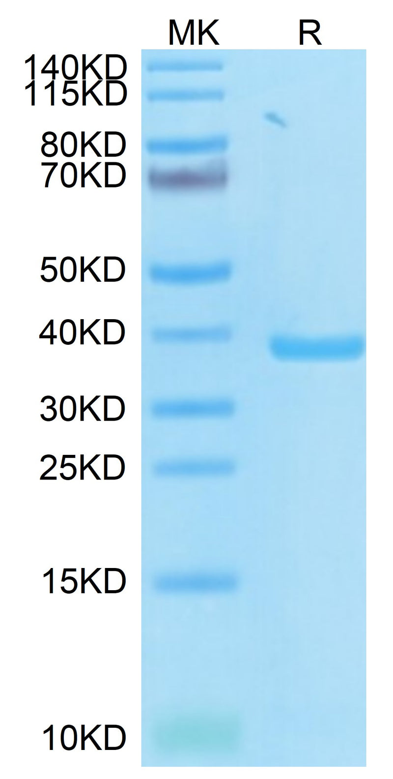 SARS-CoV-2 PLpro on Tris-Bis PAGE under reduced condition. The purity is greater than 95%.