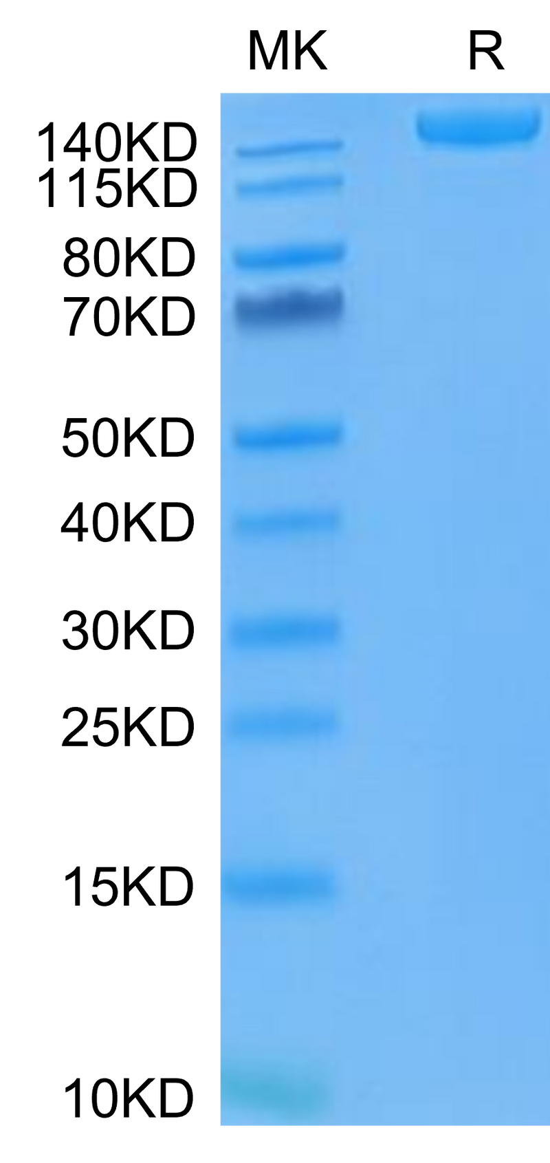 SARS-COV-2 Spike S Trimer (D614G) on Tris-Bis PAGE under reduced condition. The purity is greater than 95%.