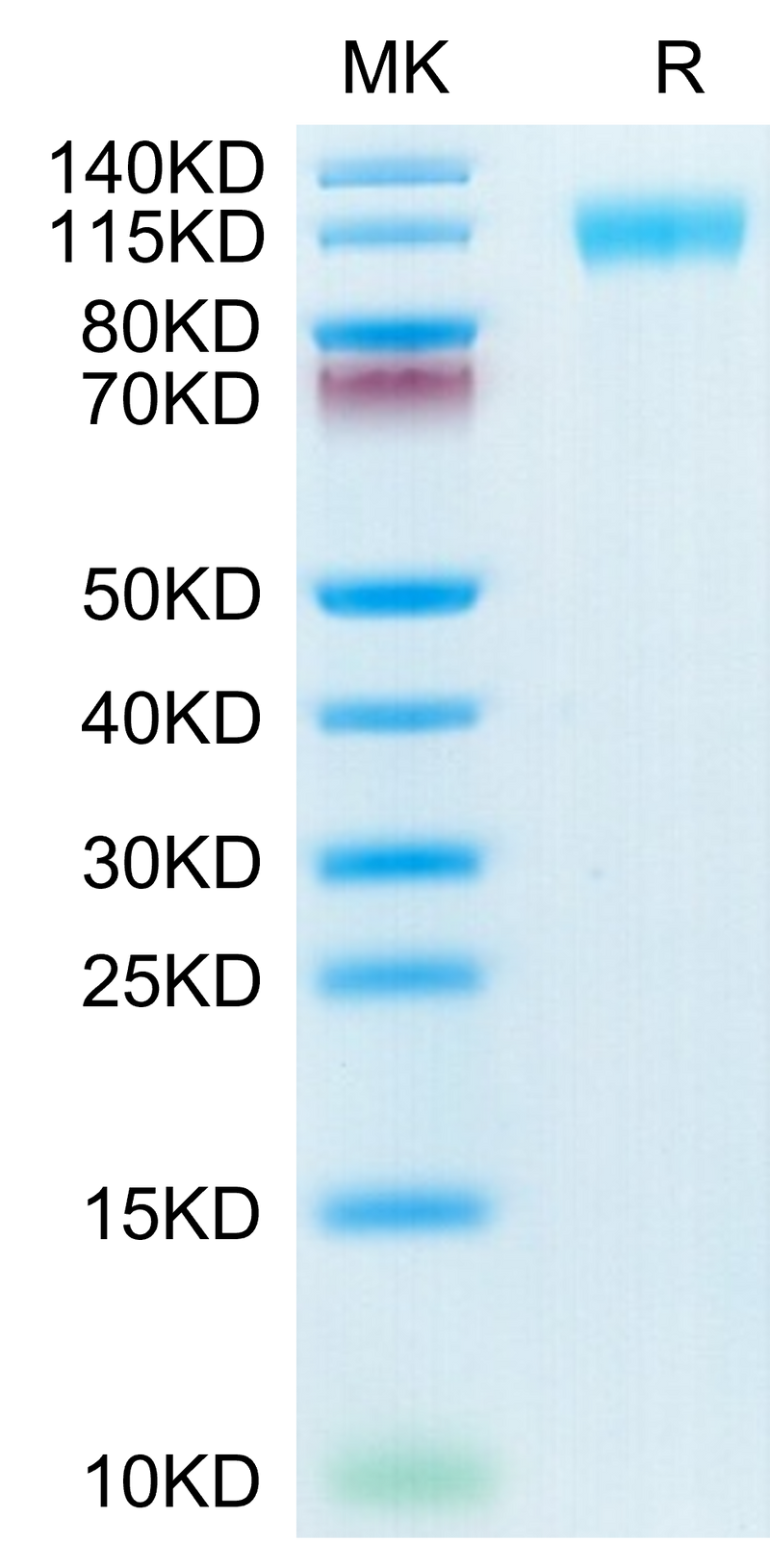 SARS-COV-2 Spike S1 (N501Y,K417N,E484K) on Tris-Bis PAGE under reduced condition. The purity is greater than 95%.