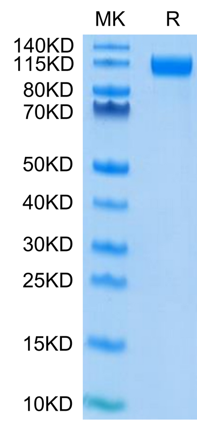 SARS-COV-2 Spike S1 (D614G) on Tris-Bis PAGE under reduced condition. The purity is greater than 95%.