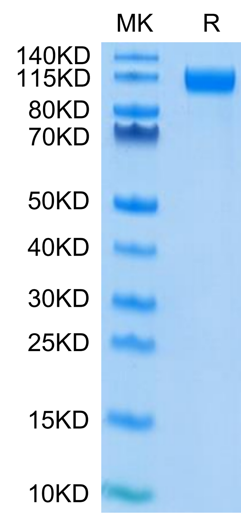 SARS-COV-2 Spike S1 (D614G) on Tris-Bis PAGE under reduced condition. The purity is greater than 95%.