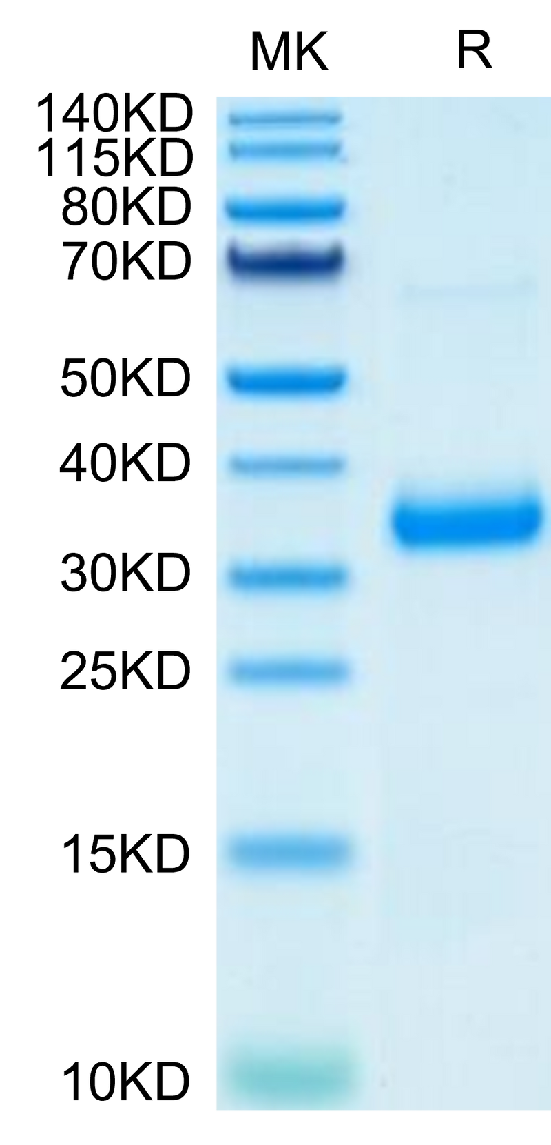 SARS-COV-2 Spike RBD (N501Y,K417N,E484K) on Tris-Bis PAGE under reduced condition. The purity is greater than 95%.