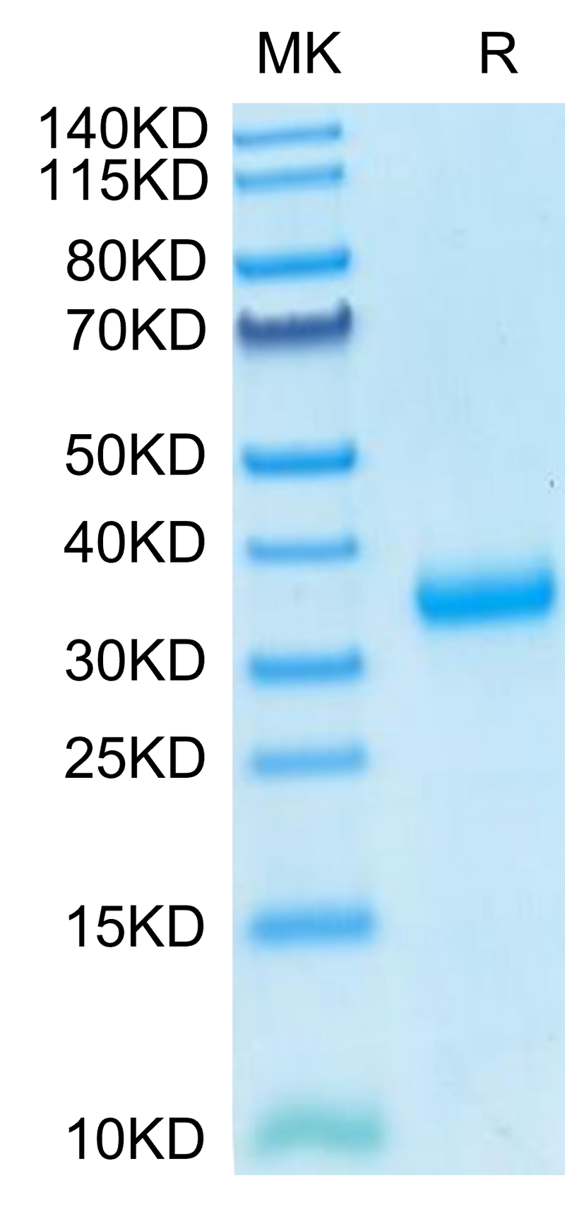 SARS-COV-2 Spike RBD (N501Y) on Tris-Bis PAGE under reduced condition. The purity is greater than 95%.