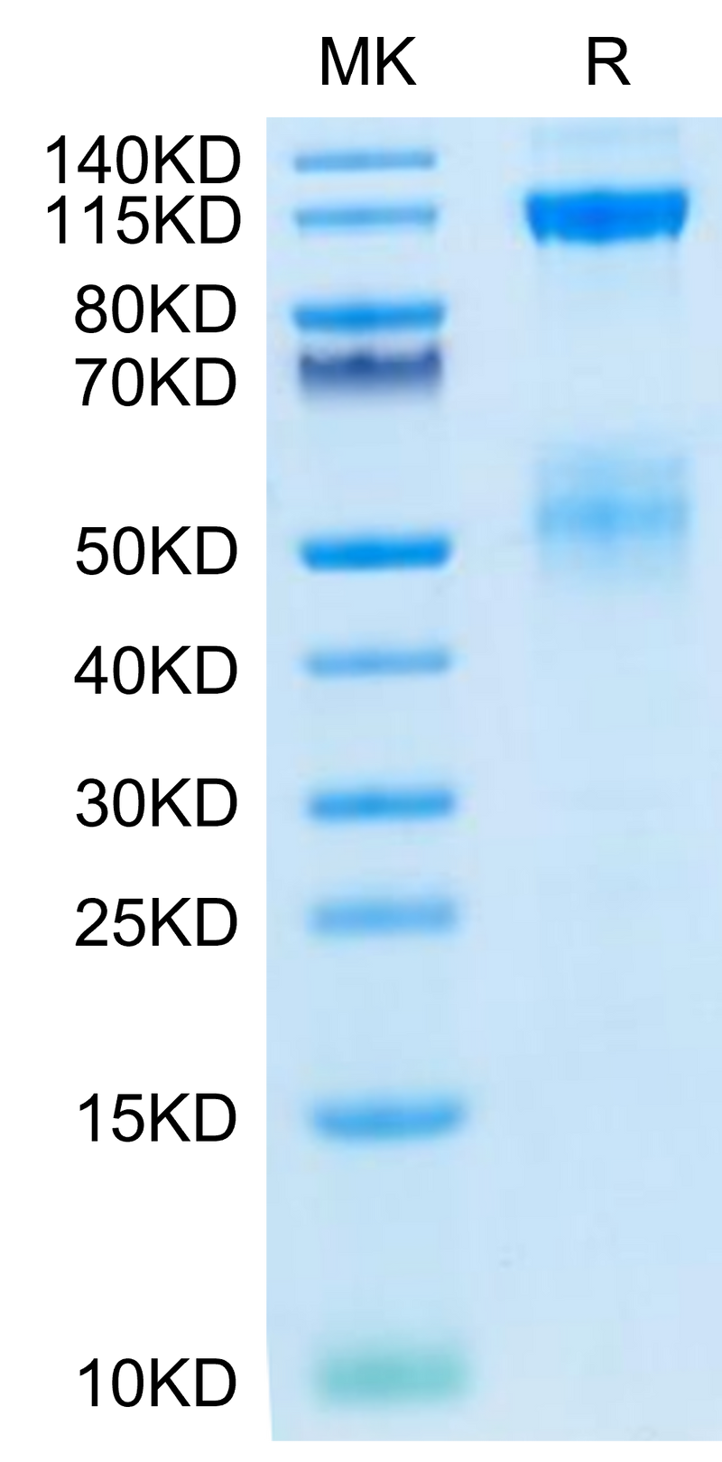 Biotinylated Human IGF1R on Tris-Bis PAGE under reduced condition. The purity is greater than 95%.