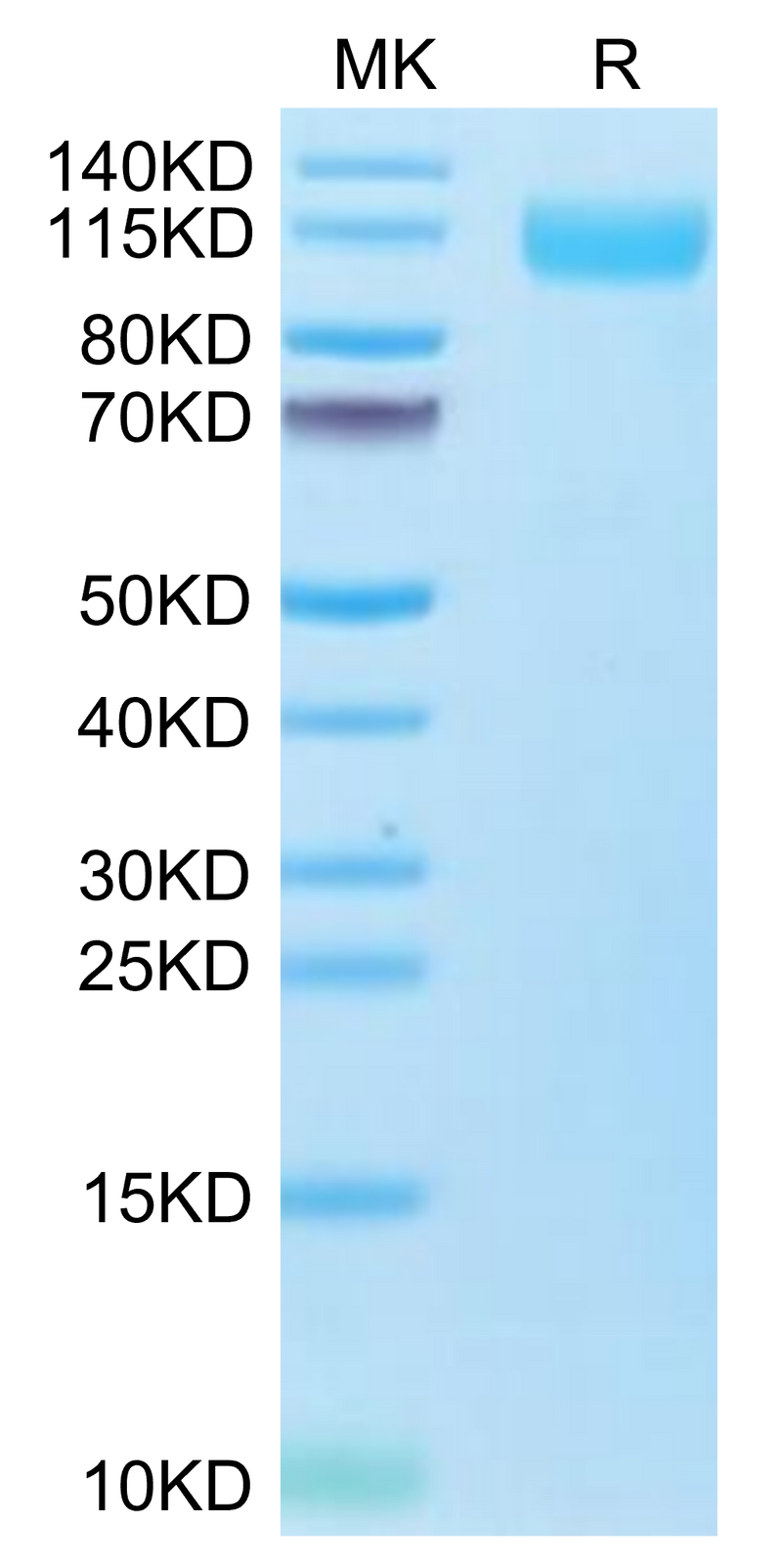 Biotinylated SARS-COV-2 Spike S1 (Omicron B.1.1.529) on Tris-Bis PAGE under reduced condition. The purity is greater than 95%.