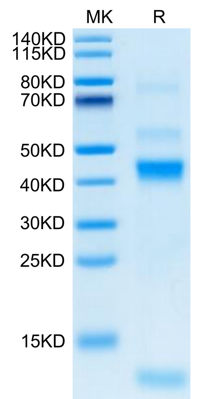 Rhesus macaque Latent TGF beta 1 on Tris-Bis PAGE under reduced condition. The purity is greater than 95%.