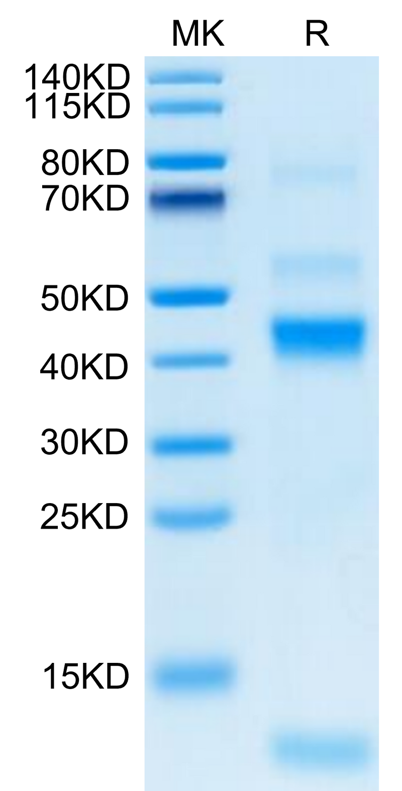 Rhesus macaque Latent TGF beta 1 on Tris-Bis PAGE under reduced condition. The purity is greater than 95%.