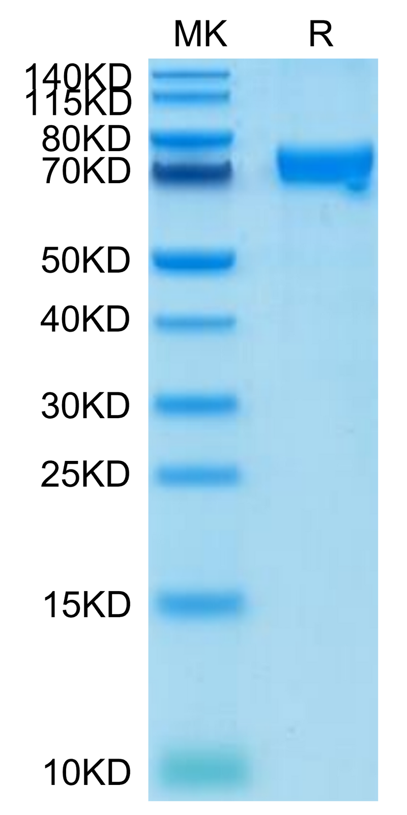 Cynomolgus CRTAM on Tris-Bis PAGE under reduced condition. The purity is greater than 95%.