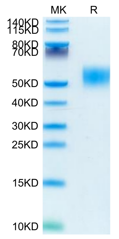 Mouse GM-CSF R alpha on Tris-Bis PAGE under reduced condition. The purity is greater than 95%.