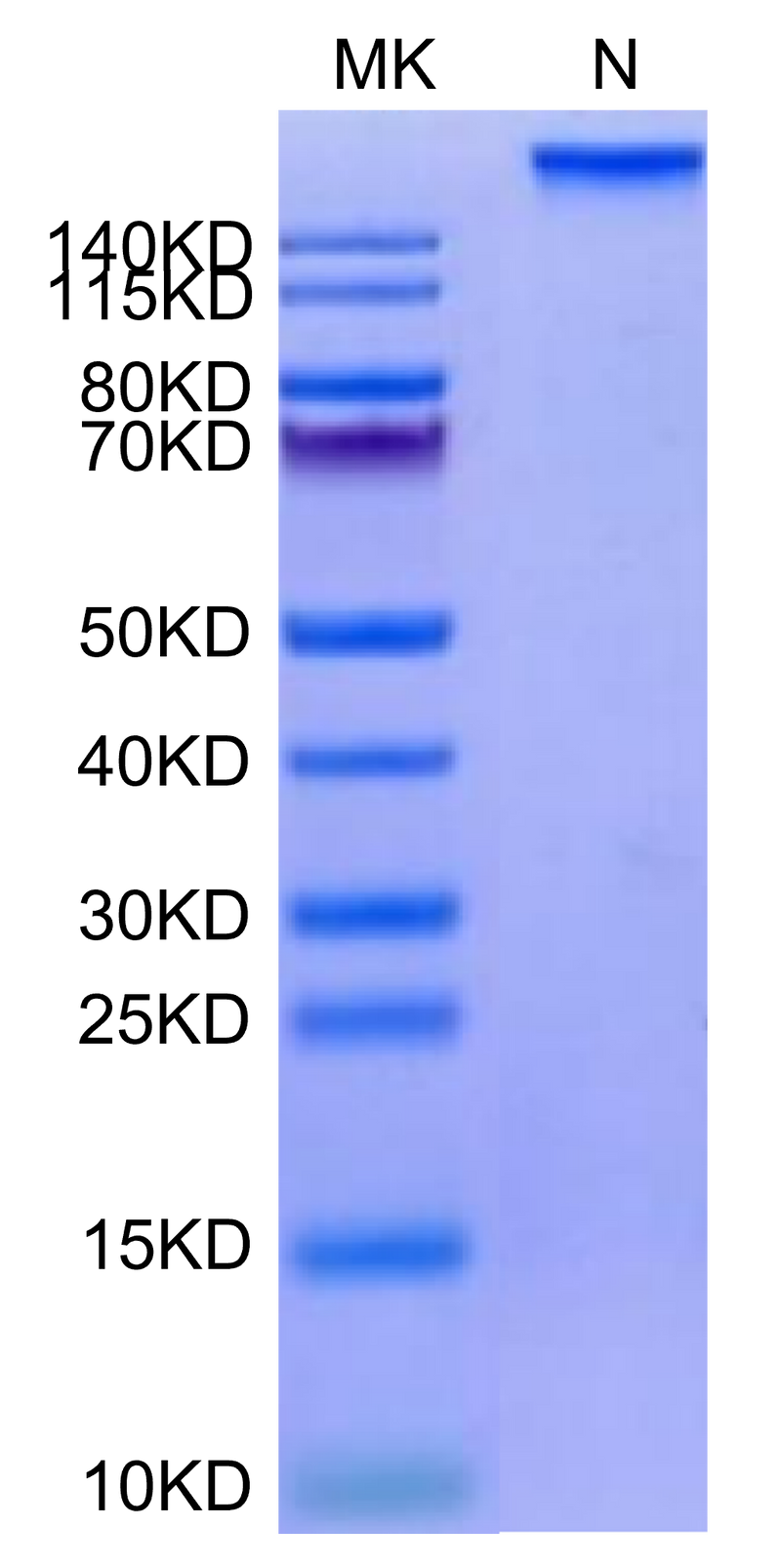 Human HLA-A*02:01&B2M&HPV16 E7 (YMLDLQPET) Tetramer on Tris-Bis PAGE under under Non reducing (N) condition. The purity is greater than 95%.