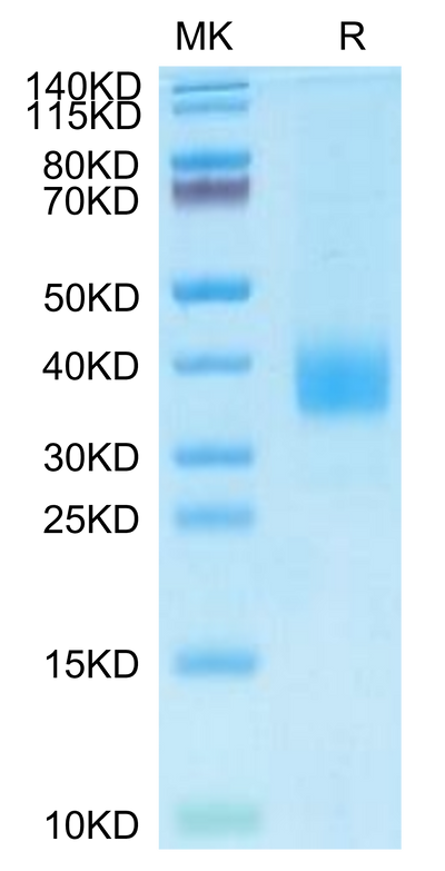 Cynomolgus Siglec-15 on Tris-Bis PAGE under reduced condition. The purity is greater than 95%.