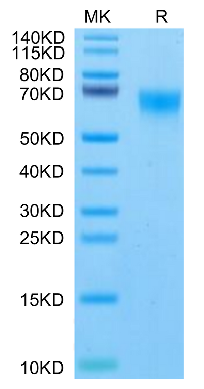 Rhesus macaque FGFR4 on Tris-Bis PAGE under reduced condition. The purity is greater than 95%.