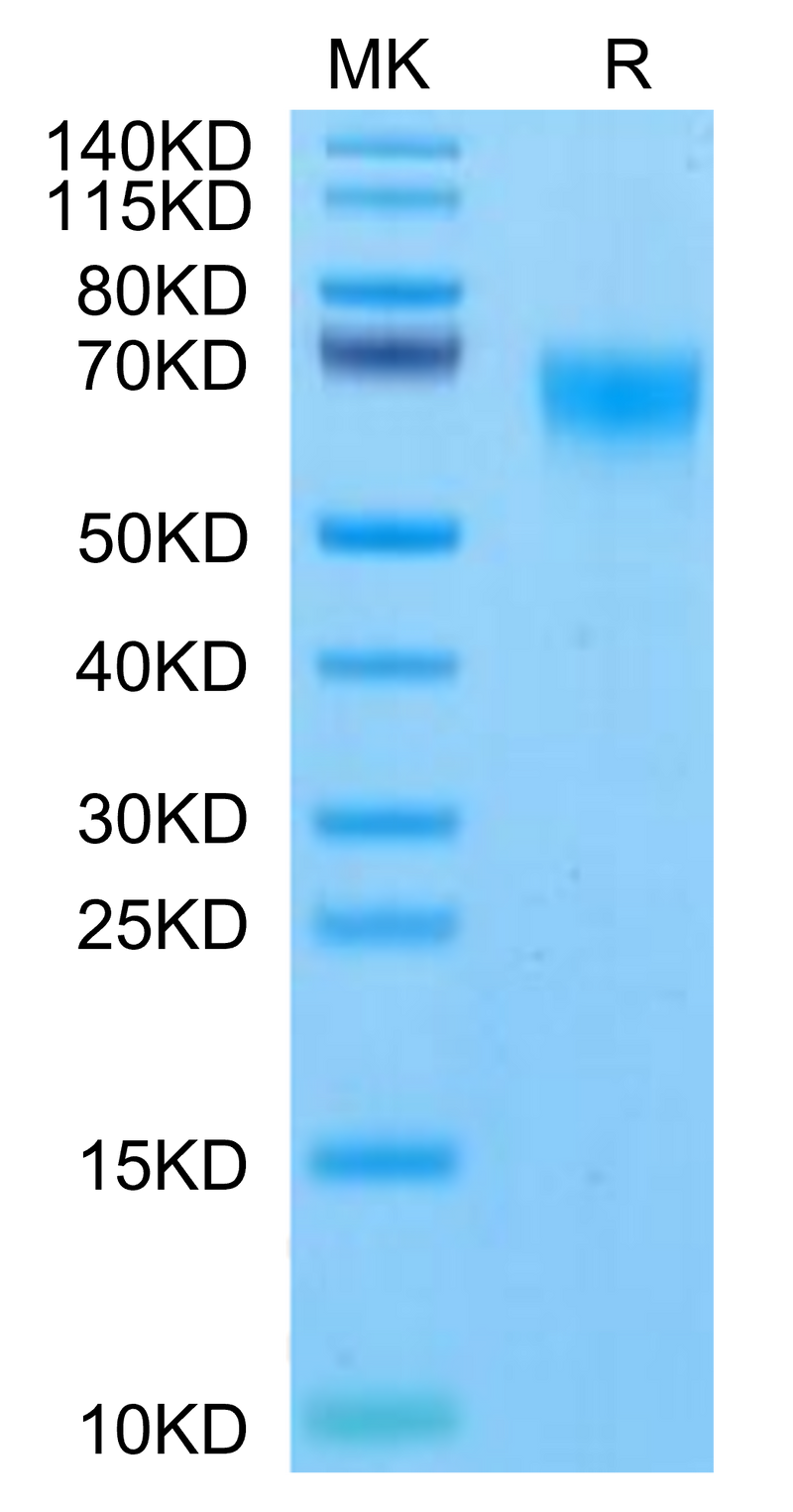 Rhesus macaque FGFR4 on Tris-Bis PAGE under reduced condition. The purity is greater than 95%.