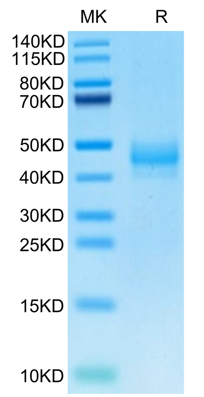 Rhesus macaque CTGF on Tris-Bis PAGE under reduced condition. The purity is greater than 95%.