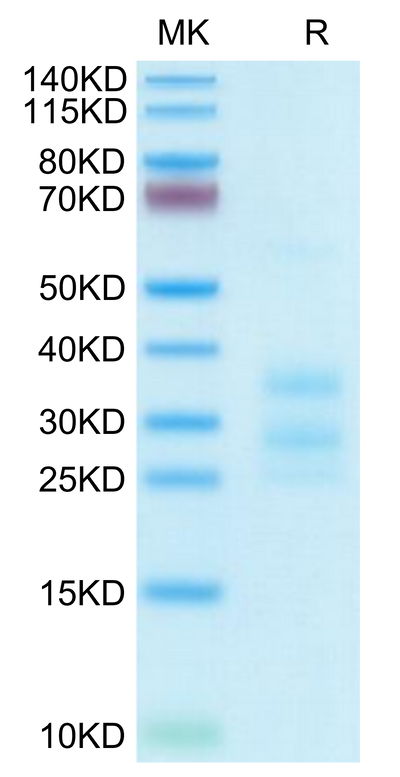 Human CD3E&CD3G on Tris-Bis PAGE under reduced condition. The purity is greater than 95%.