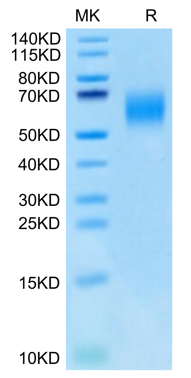 Cynomolgus IL-13Ra1 on Tris-Bis PAGE under reduced condition. The purity is greater than 95%.