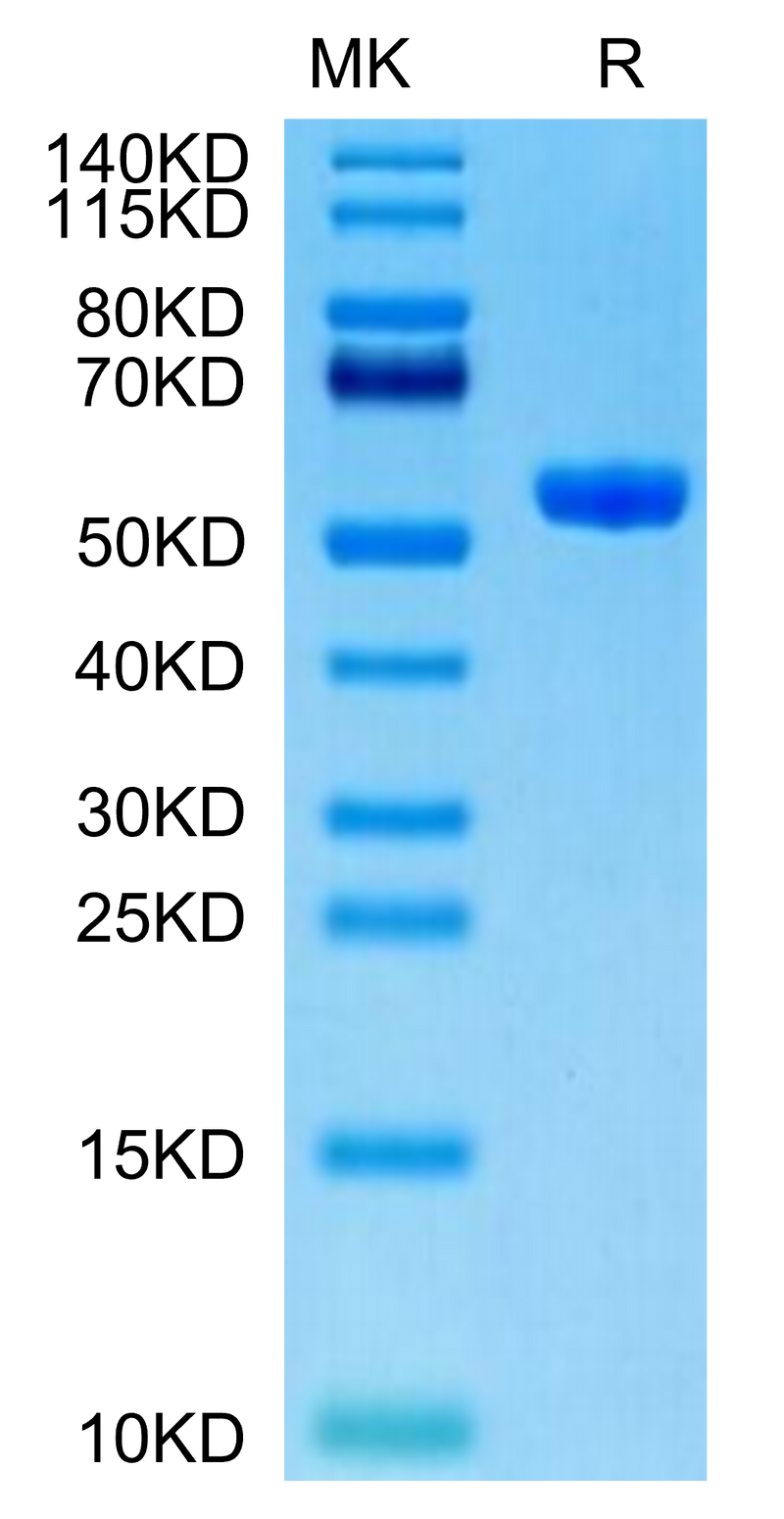 Human HLA-A*11:01&B2M&KRAS WT (VVVGAGGVGK) Monomer on Tris-Bis PAGE under reduced condition. The purity is greater than 95%.