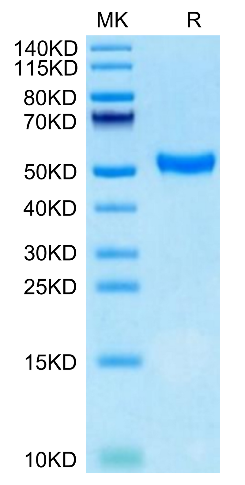 Human CD5 on Tris-Bis PAGE under reduced condition. The purity is greater than 95%.