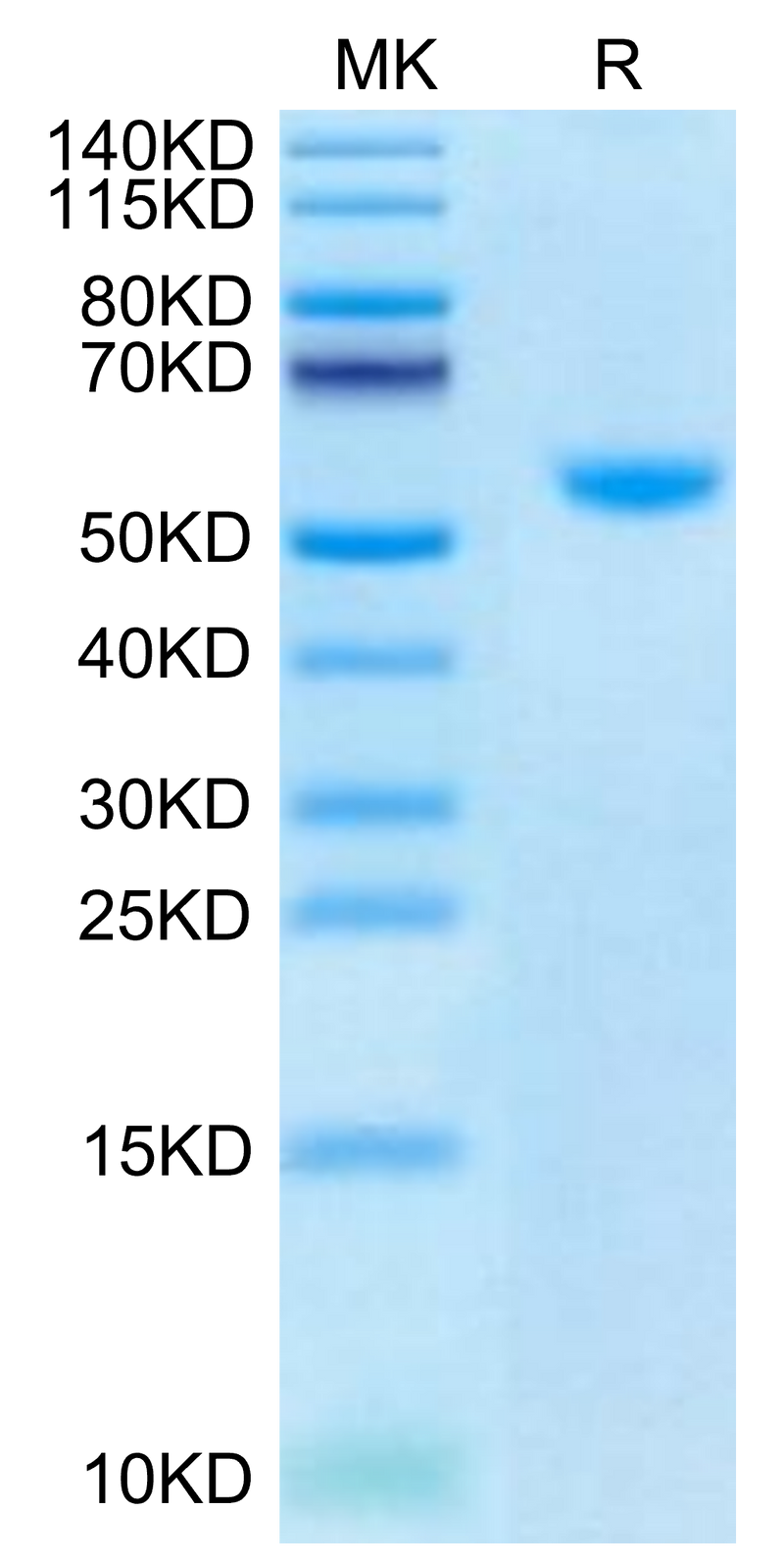 Biotinylated Human CD40 Ligand Trimer on Tris-Bis PAGE under reduced condition. The purity is greater than 95%.