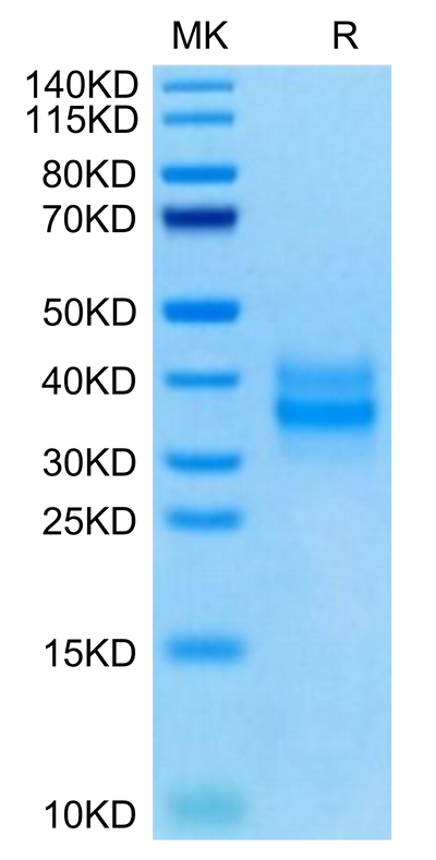 Mouse FOLR1 on Tris-Bis PAGE under reduced condition. The purity is greater than 95%.