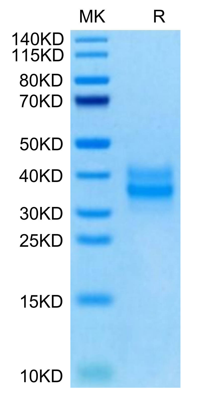 Mouse FOLR1 on Tris-Bis PAGE under reduced condition. The purity is greater than 95%.