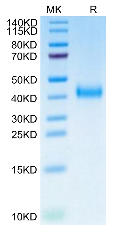 Biotinylated Cynomolgus IL-2 R beta on Tris-Bis PAGE under reduced condition. The purity is greater than 95%.