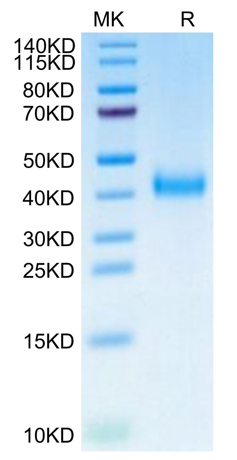 Biotinylated Cynomolgus IL-2 R beta on Tris-Bis PAGE under reduced condition. The purity is greater than 95%.