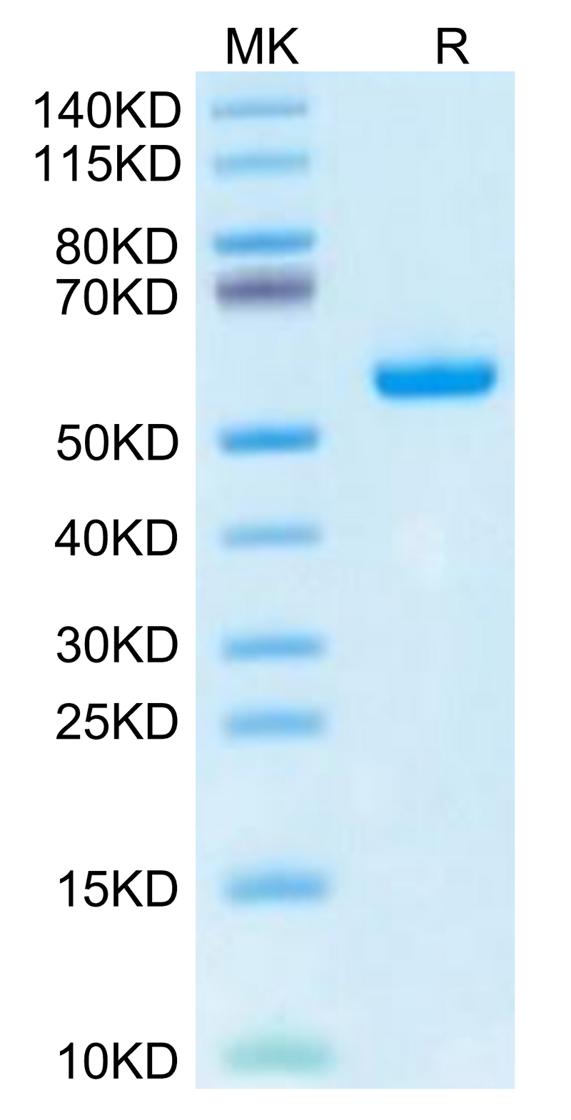 Human HLA-A*02:03&B2M&AFP (FMNKFIYEI) Monomer on Tris-Bis PAGE under reduced condition. The purity is greater than 95%.