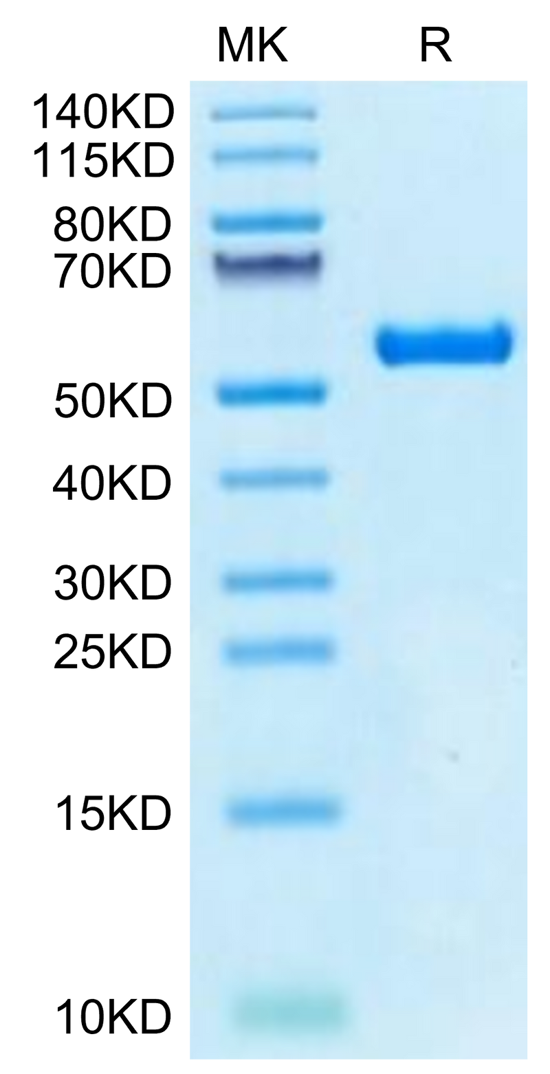 Biotinylated Human HLA-A*02:03&B2M&AFP (FMNKFIYEI) Monomer on Tris-Bis PAGE under reduced condition. The purity is greater than 95%.