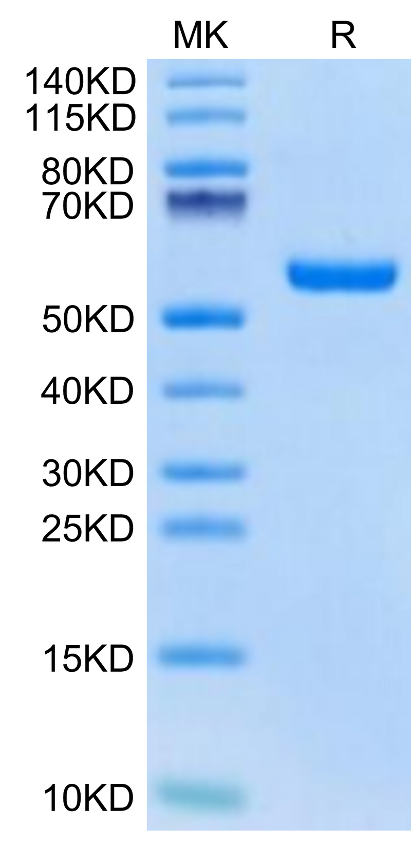 Biotinylated Human HLA-A*02:01&B2M&Survivin (LMLGEFLKL) Monomer on Tris-Bis PAGE under reduced condition. The purity is greater than 95%.