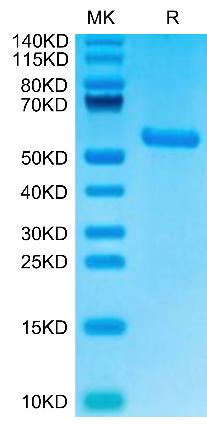 Biotinylated Human HLA-A*02:01&B2M&AFP (PLFQVPEPV) Monomer on Tris-Bis PAGE under reduced condition. The purity is greater than 95%.