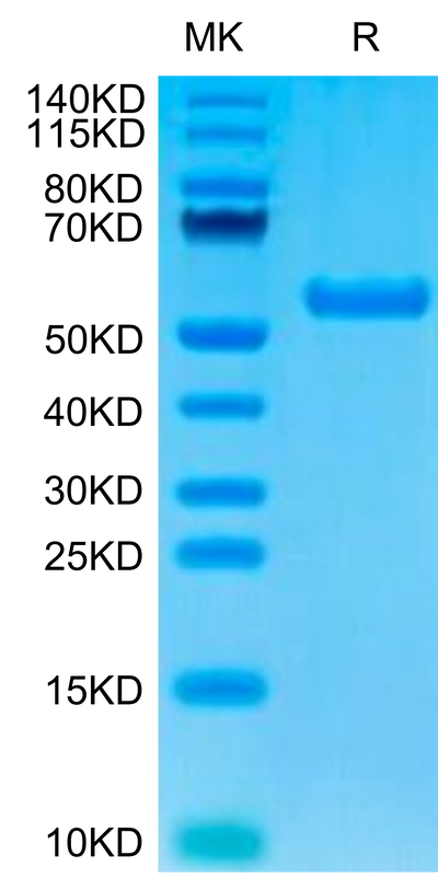 Biotinylated Human HLA-A*02:01&B2M&AFP (FMNKFIYEI) Monomer on Tris-Bis PAGE under reduced condition. The purity is greater than 95%.