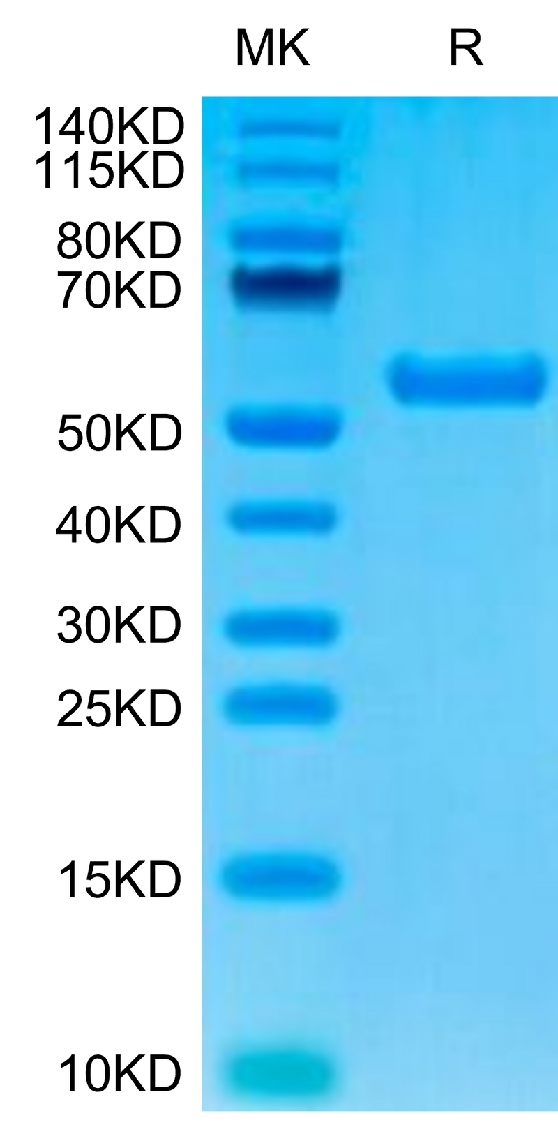 Biotinylated Human HLA-A*02:01&B2M&AFP (FMNKFIYEI) Monomer on Tris-Bis PAGE under reduced condition. The purity is greater than 95%.