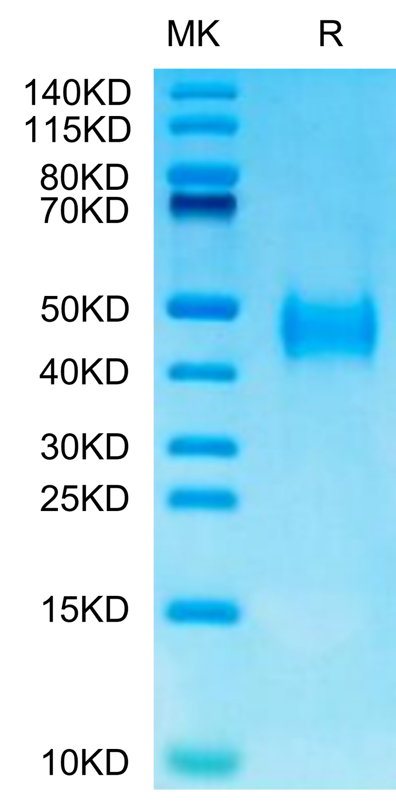 Mouse B7-H3 on Tris-Bis PAGE under reduced condition. The purity is greater than 95%.