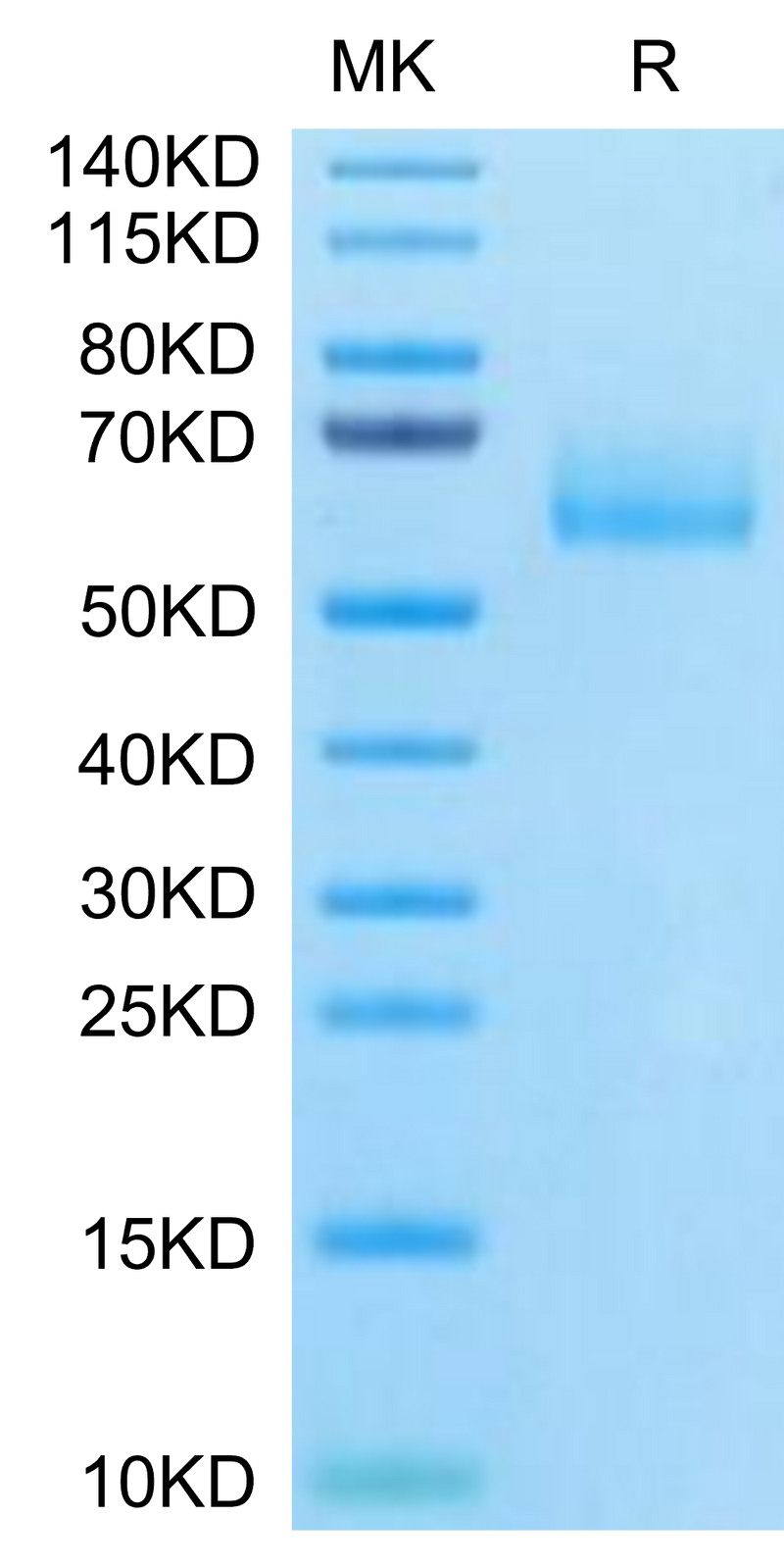 Human MUC1 Isoform Y on Tris-Bis PAGE under reduced condition. The purity is greater than 95%.