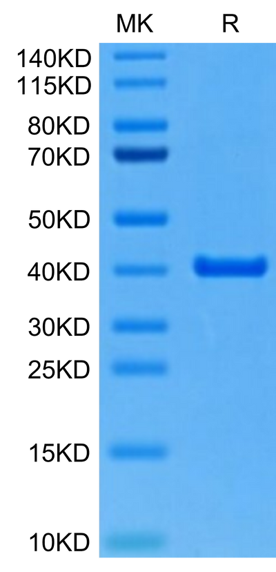 Mouse ANXA2 on Tris-Bis PAGE under reduced condition. The purity is greater than 95%.