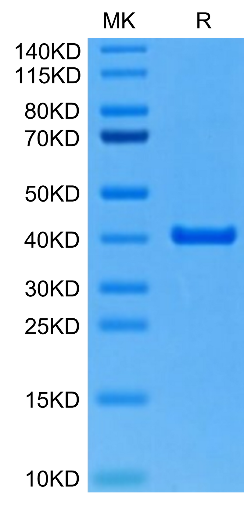 Mouse ANXA2 on Tris-Bis PAGE under reduced condition. The purity is greater than 95%.