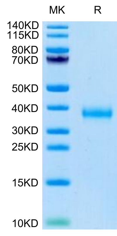 SARS-COV-2 Spike RBD (Delta B.1.617.2) on Tris-Bis PAGE under reduced condition. The purity is greater than 95%.