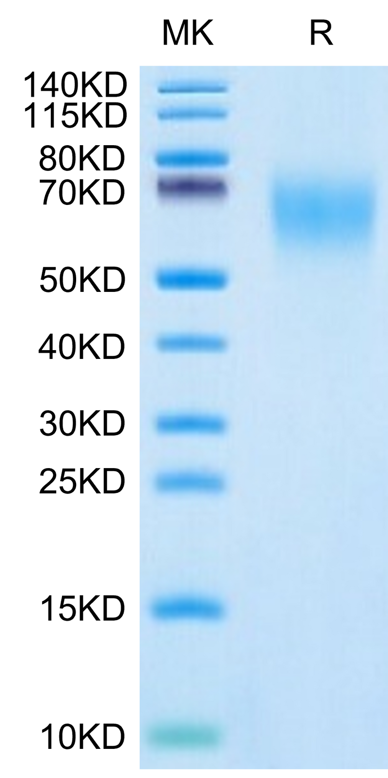 Cynomolgus CEACAM-6 on Tris-Bis PAGE under reduced condition. The purity is greater than 95%.