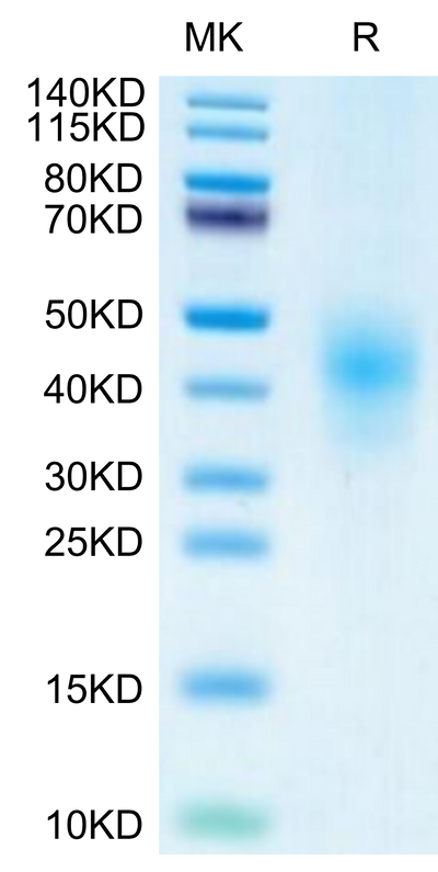 Cynomolgus NKG2D on Tris-Bis PAGE under reduced condition. The purity is greater than 95%.