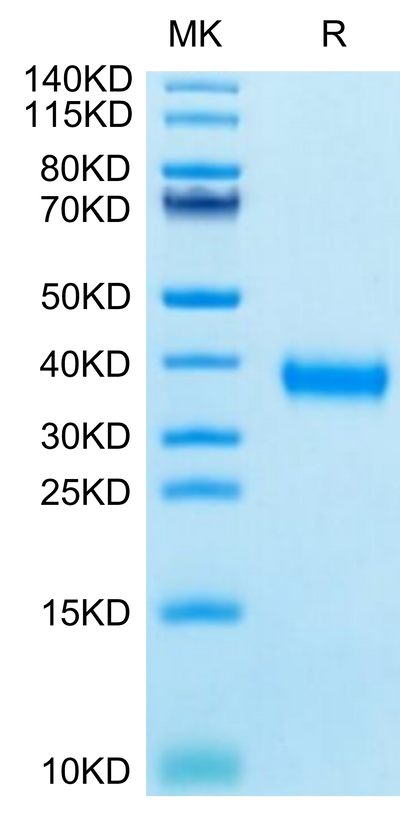 SARS-CoV-2 Spike RBD (Gamma P.1/P.1.1/P.1.2) on Tris-Bis PAGE under reduced condition. The purity is greater than 95%.