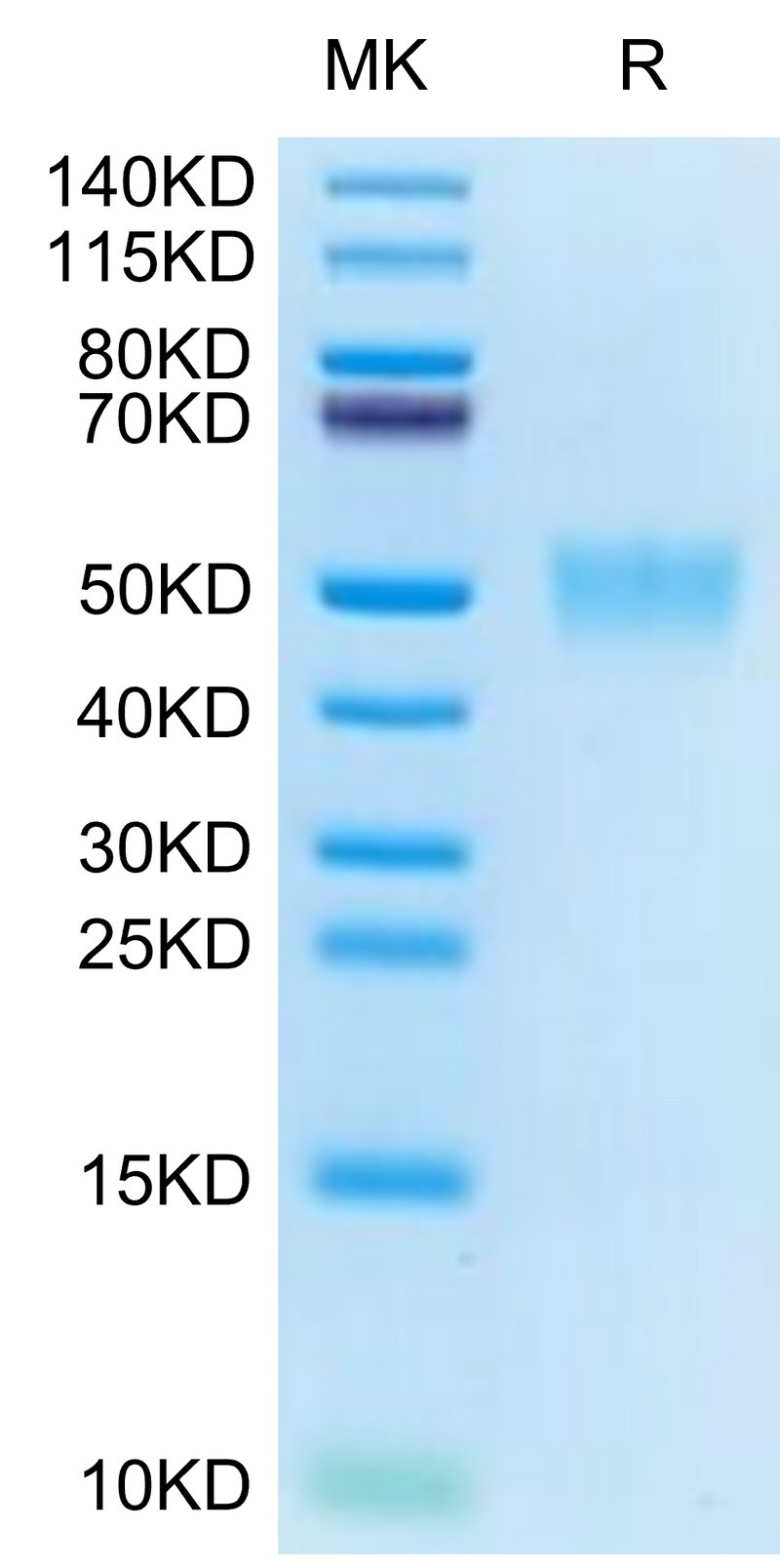 Cynomolgus CD200 on Tris-Bis PAGE under reduced condition. The purity is greater than 95%.