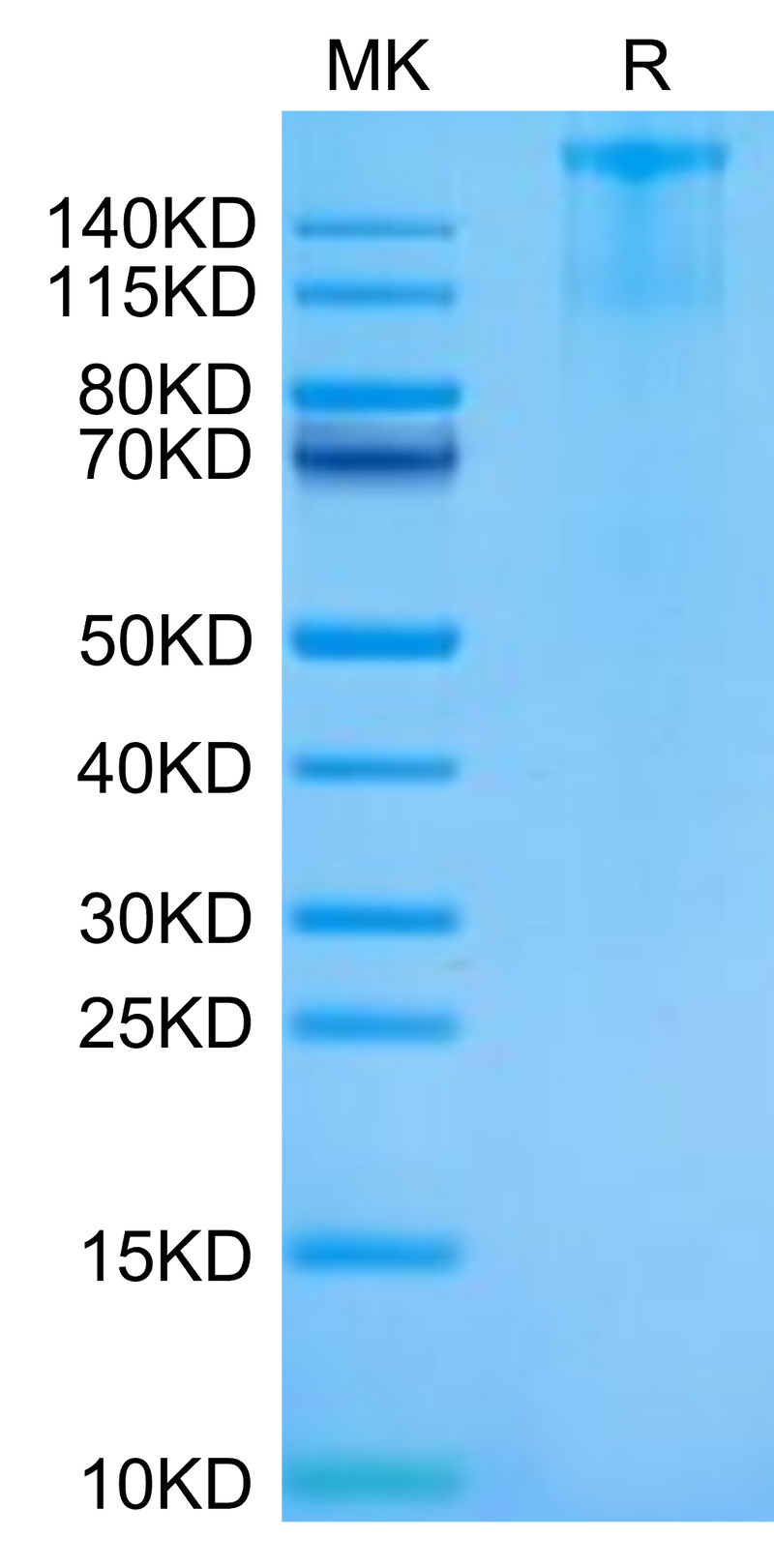 Cynomolgus FLT3 on Tris-Bis PAGE under reduced condition. The purity is greater than 95%.